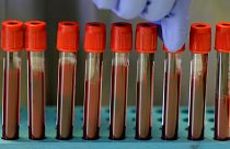 Blood samples from volunteers are handled in the laboratory at Imperial College in London