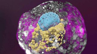 Kök hücreden türetilen bir insan embriyo modeli