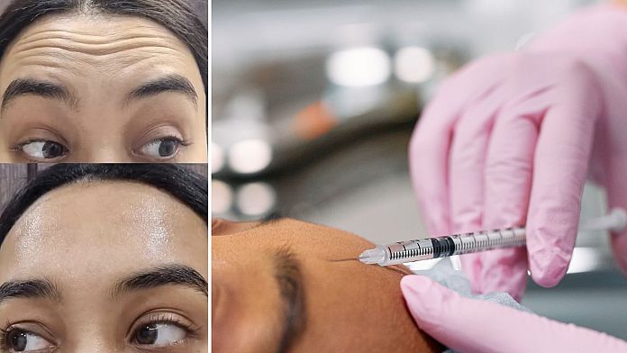 Turismo medico: le cliniche botox economiche della Corea del Sud sono un affare di bellezza o i prossimi "denti da tacchino"? 3 Turismo medico: le cliniche botox economiche della Corea del Sud sono un affare di bellezza o i prossimi "denti da tacchino"?