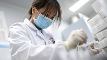 A laboratory technician conducts an artificial intelligence (AI)-based cervical cancer screening at a test facility in Wuhan, China. 2023