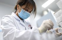 A laboratory technician conducts an artificial intelligence (AI)-based cervical cancer screening at a test facility in Wuhan, China. 2023