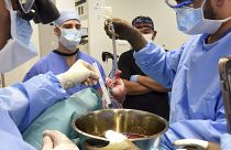  عملية جراحية لزرع قلب خنزير معدل جينيا لإنسان في مستشفى كليّة الطب بجامعة ميريلاند في الولايات المتحدة
