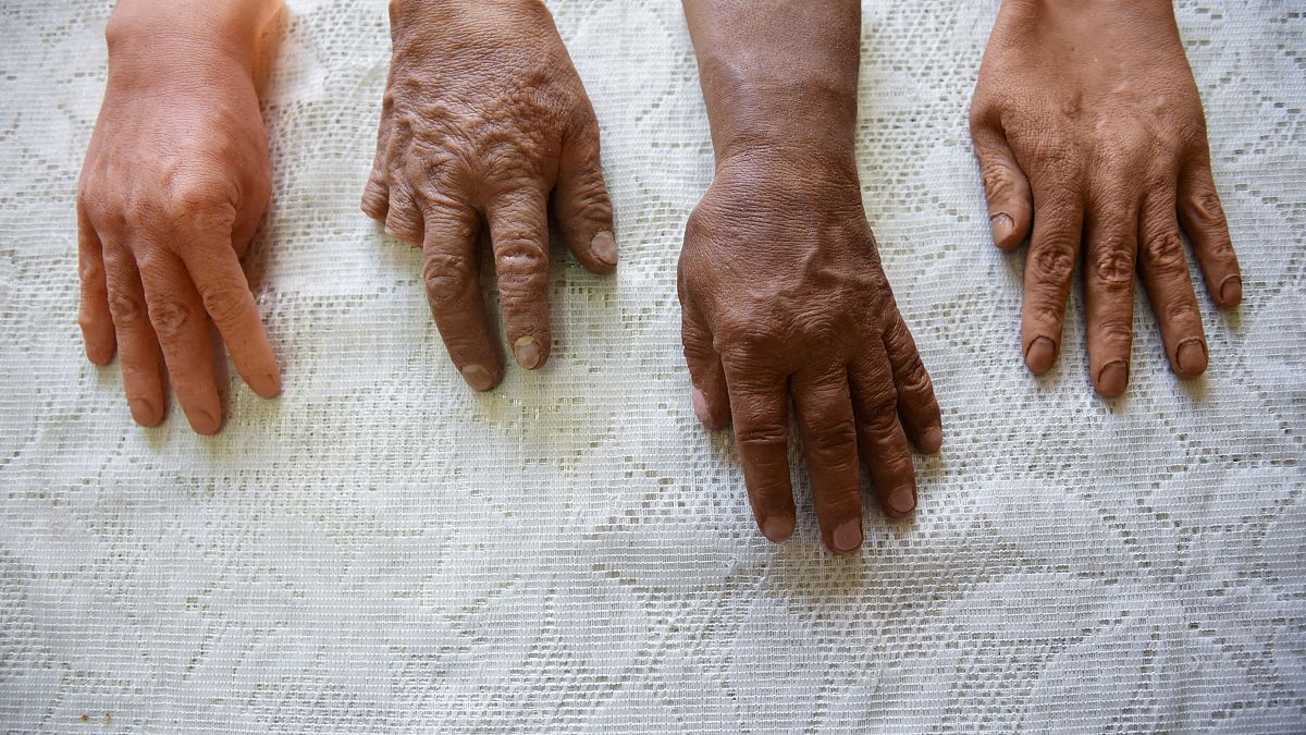 Hyperrealistic prosthetic hands for the disabled, in La Paz, Bolivia September 19, 2023.