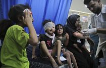 کودکان فلسطینی که بر اثر حملات اسرائیل در غزه زخمی شده‌اند