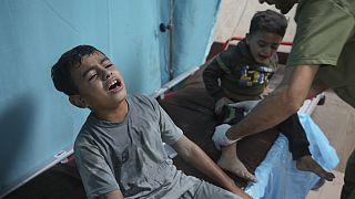 Palestinians wounded in Israeli bombardment wait for treatment in a hospital in Deir al-Balah, south of the Gaza Strip.