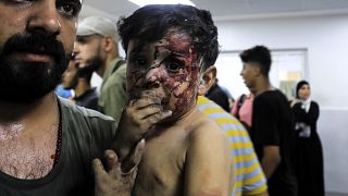 Ein verletzter Junge in Gaza