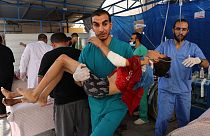 Des membres d'une équipe médicale transportent un garçon blessé par une frappe israélienne dans une salle d'urgence improvisée à l'extérieur de l'hôpital Koweït, à Rafah,.