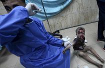 طفل مصاب يصل إلى مستشفى دير البلح