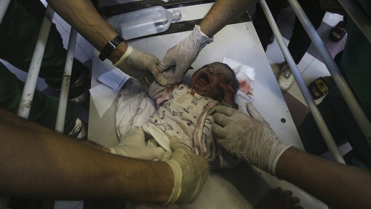 Légicsapásban mgsebesült palesztin csecsemő a gázai Al-Shifa kórházban 2023. október 23-án
