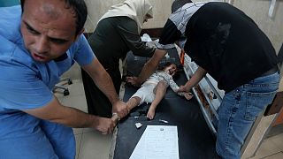 A Palestinian child wounded in the Israeli bombardment of the Gaza Strip is treated in al Aqsa Hospital in Deir al Balah on Tuesday, Oct. 31, 2023.