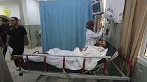 A Palestinian wounded in the Israeli bombardment of the Gaza Strip waits for treatment in a hospital in Rafah on Saturday, Oct. 28, 2023.