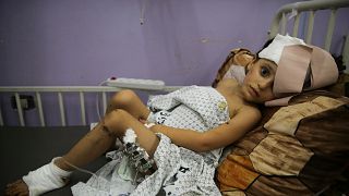 Kenzi al Madhoun, a four-year-old who was wounded in Israeli bombardment, lies at Al Aqsa Hospital in Deir al Balah City, Gaza Strip on Wednesday