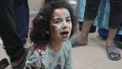 Palestinian child wounded in Israeli bombardment is brought to a hospital in Deir al Balah, south of the Gaza Strip, Thursday, Nov. 2, 2023.