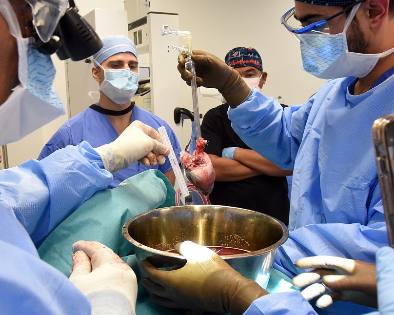 Doctors performing an experimental pig's heart transplant.