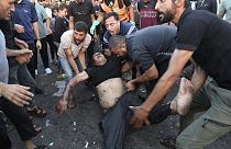 An injured Palestinian man is carried from the ground following an Israeli airstrike outside the entrance of the al-Shifa hospital in Gaza City.