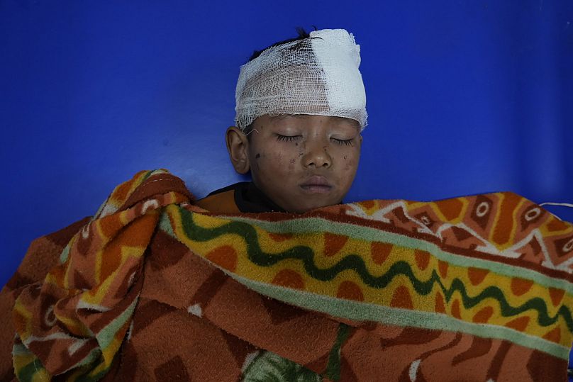A földrengésben megsérült nepáli kisfiú egy kórházban