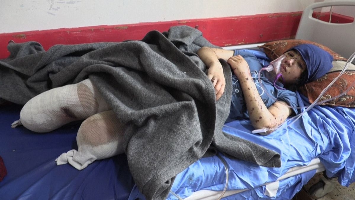 İsrail saldırısı sonrası ampute edilen 13 yaşındaki Filistinli Layan: Bacaklarımı geri istiyorum