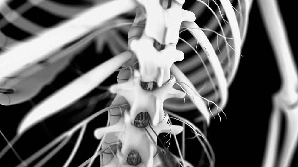 Изображението показва концептуално изобразяване на системата от гръбначни електроди която