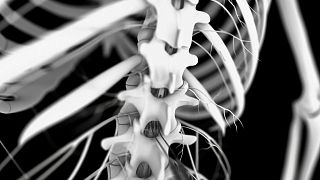 Image shows a concept rendering of the spinal electrode system that could help ease symptoms for Parkinson's disease patients.