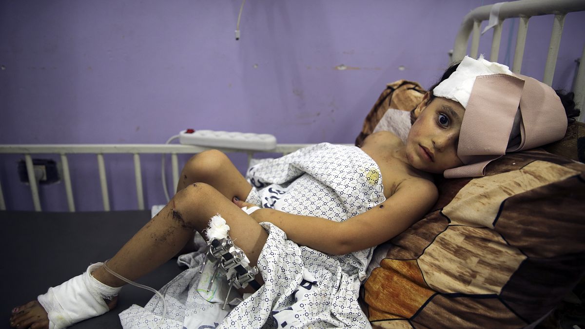 طفل فلسطيني يبلغ 4 أعوام مصاب إثر قصف إسرائيلي في مستشفى الأقصى بمدينة دير البلح بقطاع غزة.