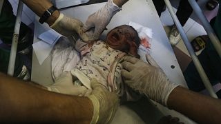 مسعفون يعالجون طفلا رضيعا فلسطينيا أصيب من جراء القصف الإسرائيلي على غزة