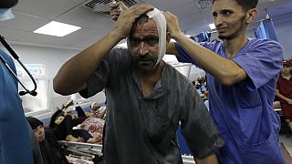 Egy sebesült palesztin férfit látnak el a gázai al-Shifa kórházban