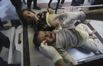 أطفال مصابون من جراء القصف الإسرائيلي يعالجون في مجمع الشفاء في غزة