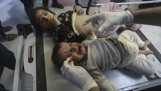 أطفال مصابون من جراء القصف الإسرائيلي يعالجون في مجمع الشفاء في غزة