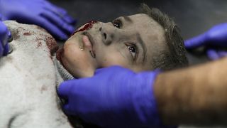 طفل فلسطيني أصيب إثر القصف الإسرائيلي على مخيم خان يونس في قطاع غزة يتلقى العلاج في مستشفى ناصر