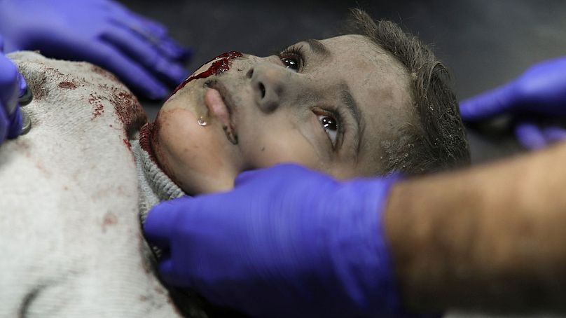 یک کودک فلسطینی زخمی در پی بمباران اسرائیل به اردوگاه آوارگان خان یونس در جنوب نوار غزه،