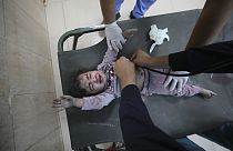Palestinian child wounded in the Israeli bombardment of the Gaza Strip is treated at al Aqsa Hospital on Deir al Balah, Gaza Strip, Tuesday, Nov. 21, 2023.