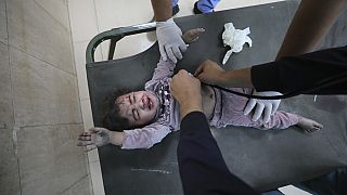 Palestinian child wounded in the Israeli bombardment of the Gaza Strip is treated at al Aqsa Hospital on Deir al Balah, Gaza Strip, Tuesday, Nov. 21, 2023.