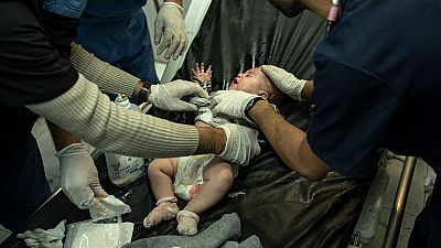 A Palestinian baby wounded in Israeli bombardment of the Gaza Strip is treated in a hospital in Khan Younis, Friday, Dec. 1, 2023. 