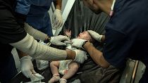 طفل مصاب في غارة إسرائيلية نُقل إلى مستئفى ناصر في خان يونس