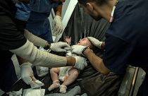 طفل مصاب في غارة إسرائيلية نُقل إلى مستئفى ناصر في خان يونس