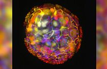 Renkli bir görüntü, yüzeyindeki kirpiklerle çevrili, hareket etmesini ve çevresini keşfetmesini sağlayan bir antrobotun çok hücreli yapısını gösteriyor