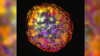 Renkli bir görüntü, yüzeyindeki kirpiklerle çevrili, hareket etmesini ve çevresini keşfetmesini sağlayan bir antrobotun çok hücreli yapısını gösteriyor