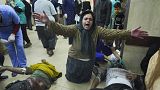 Palestinians wounded in the Israeli bombardment of the Gaza Strip are brought to the hospital in Deir al Balah on Sunday, Dec. 3, 2023.