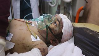 طفل فلسطيني مصاب بعد قصف إسرائيلي على رفح قطاع غزة