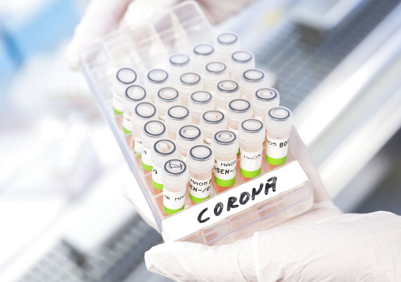 A biological-technical assistant shows prepared PCR tests for COVID-19 in Hannover, January 2022
