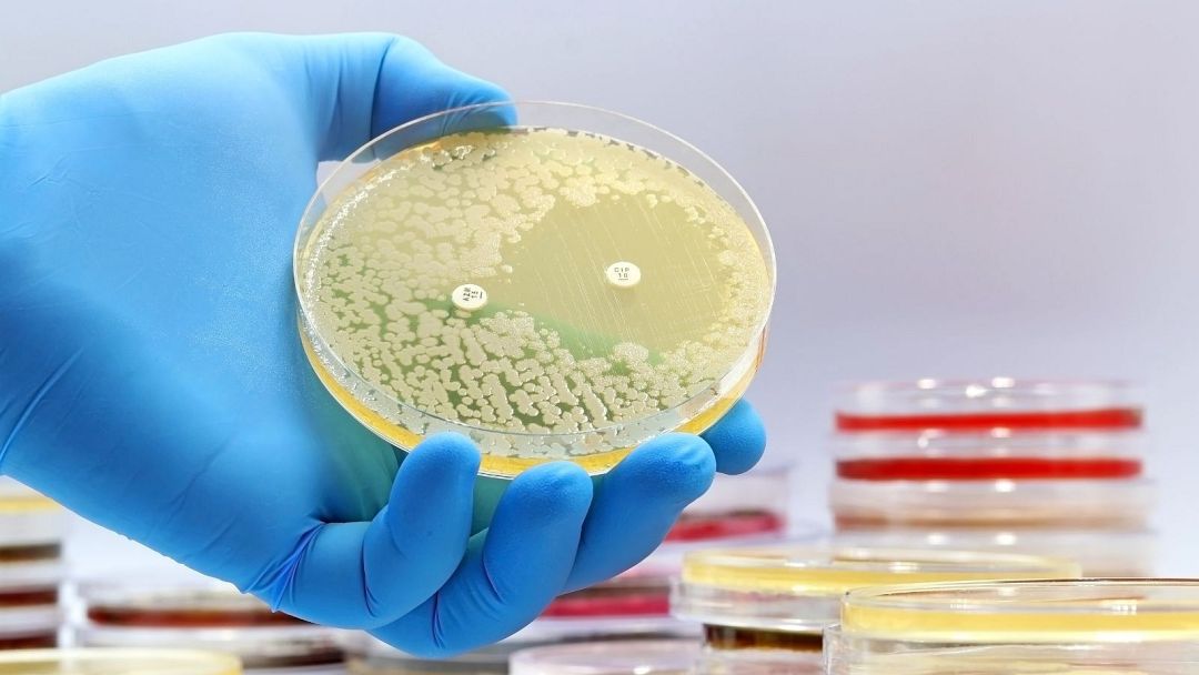 Scientists discover the first new antibiotics in over 60 years using AI ...