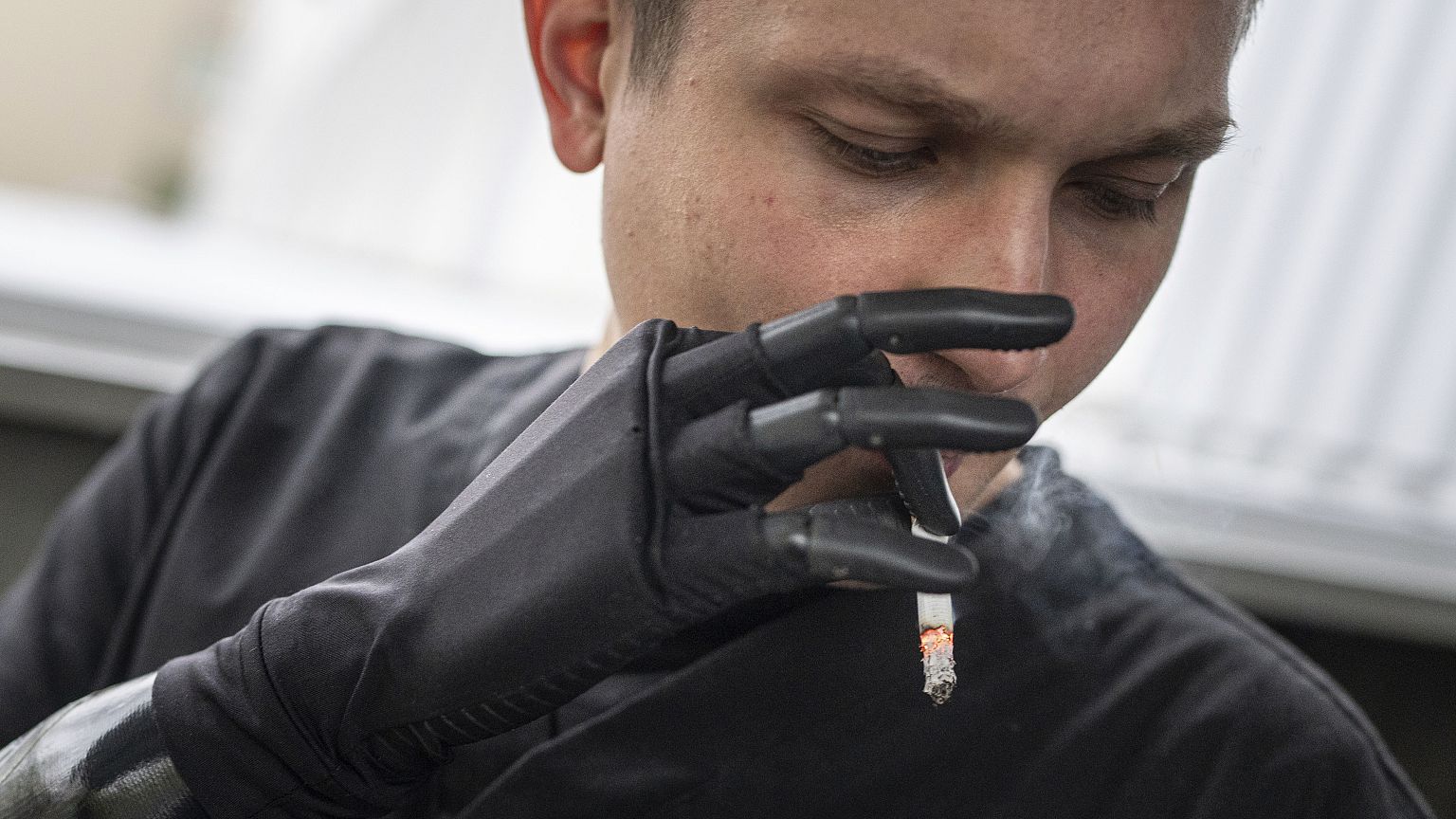 Ukraine war leads to heightened demand for bionic prosthetic limbs ...