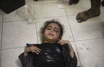طفلة فلسطينية أصيبت خلال القصف الإسرائيلي على قطاع غزة جنوب قطاع غزة
