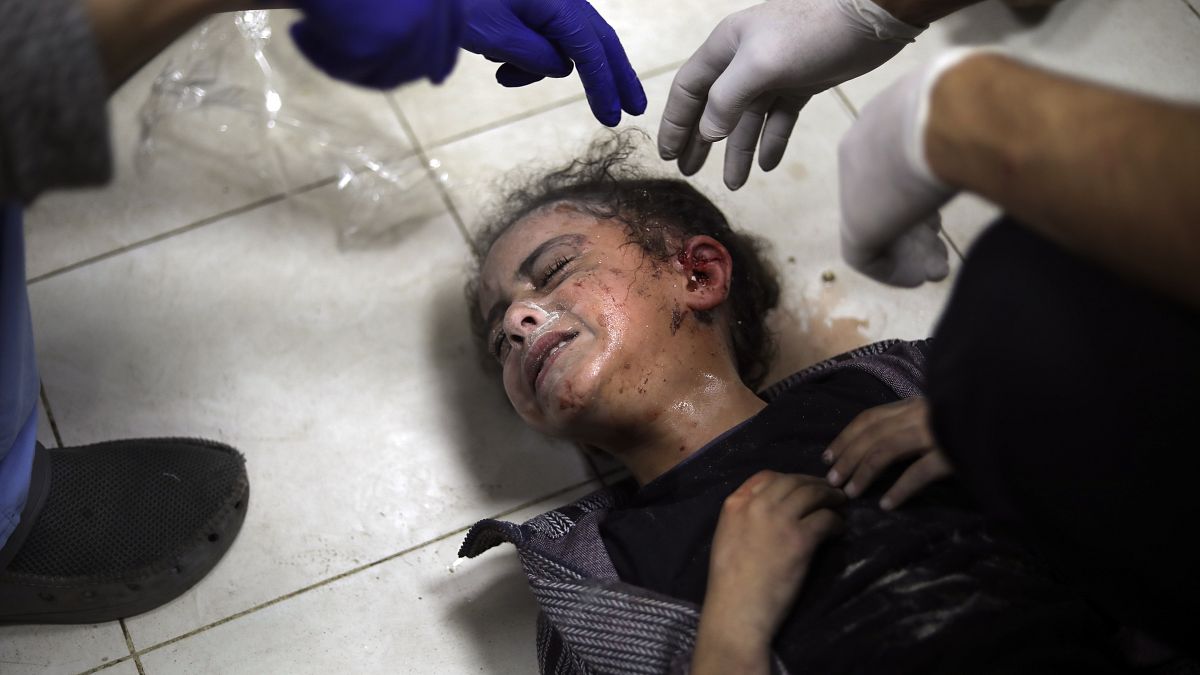 طفلة فلسطينية مصابة إثر القصف الإسرائيلي - مستشفى ناصر في خان يونس، جنوب قطاع غزة، السبت، 6 يناير، 2024