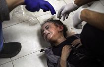 A Palestinian child wounded during the Israeli bombardment of the Gaza Strip receives treatment at the Nasser hospital in Khan Younis, Southern Gaza Strip, Saturday, Jan. 6