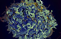 This electron microscope image shows a human T cell, in blue, under attack by HIV, in yellow, the virus that causes AIDS.