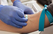 Blood test can be reliably use to detect Alzheimer's disease, a new study found.