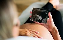 A pregnant woman holding an ultrasound.