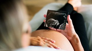 A pregnant woman holding an ultrasound.