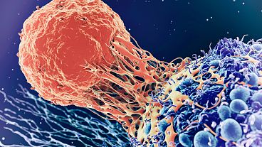 Célula T (laranja) a interagir com a célula cancerígena (azul)